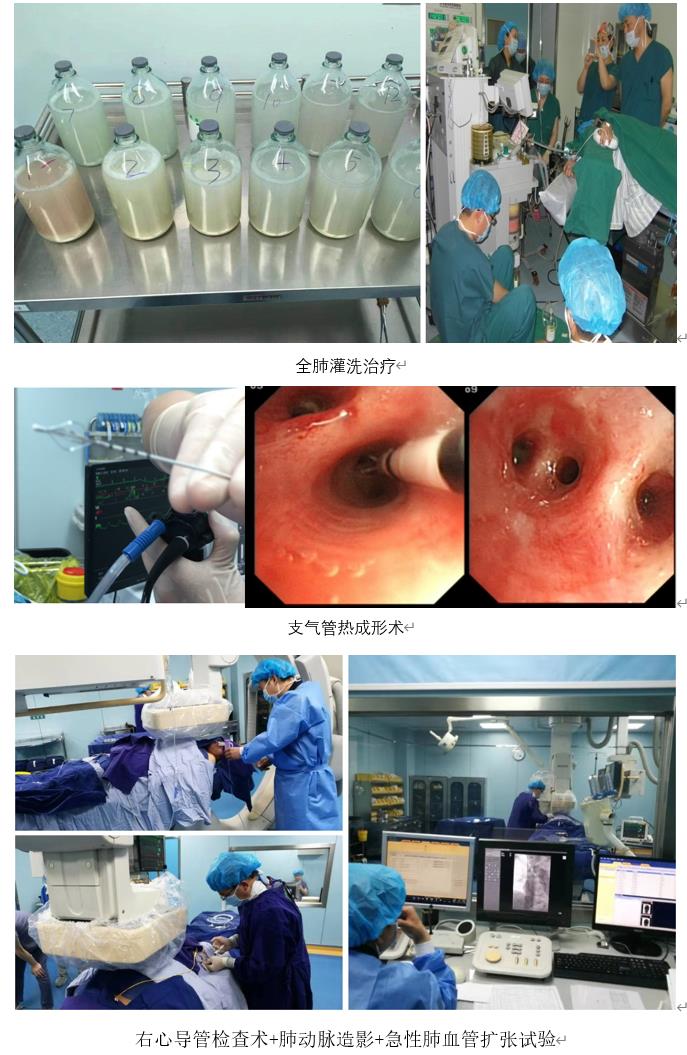 呼吸气管镜介入技术3 62fcc